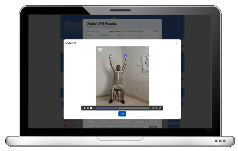 Digital DAS results with live joint tracking overlay on a guided movement